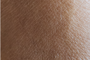 skin closeup