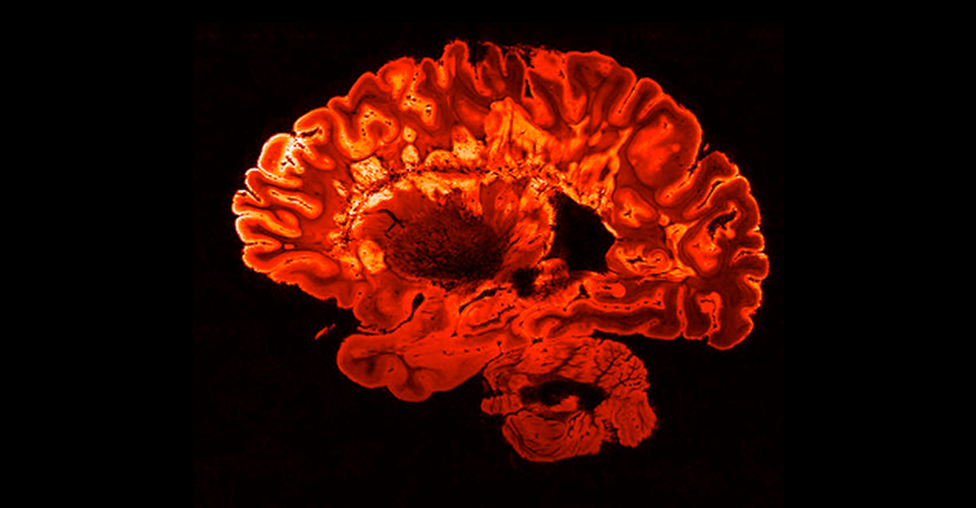 red mri brain scan
